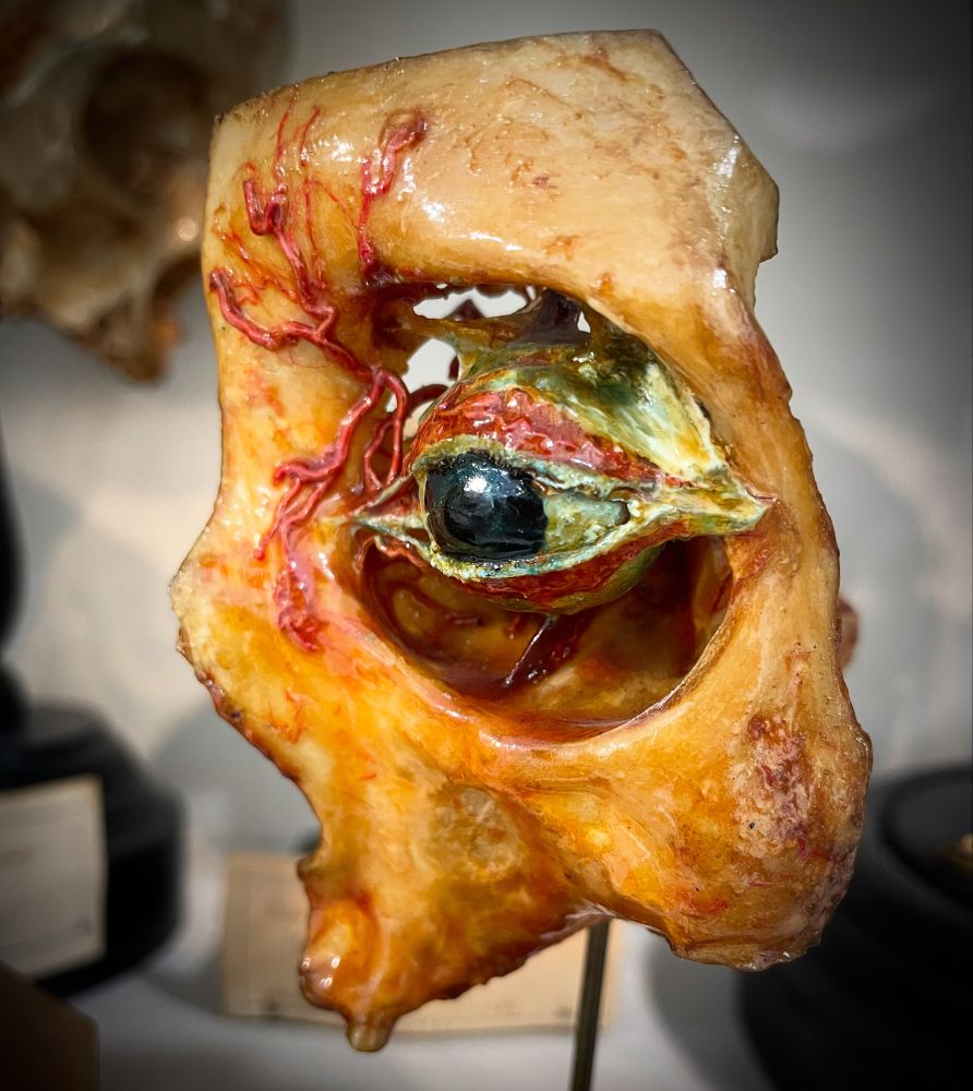 A portion of skull from around the left orbit with blood vessels injected in wax, and the eye and surrounding structures modelled in wax 