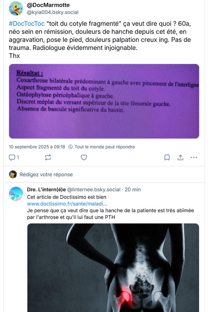 un vrai Dr pose une vrai question. Va savoir pourquoi un interne, qui n'est même pas de la spécialité décide de lui répondre avec comme source  Doctissimo. 