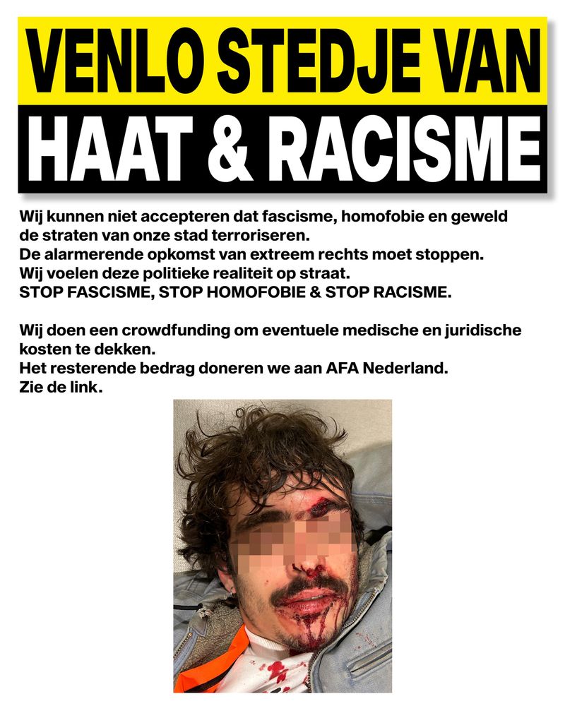 VENLO STEDJE VAN HAAT & RACISME

Wij kunnen niet accepteren dat fascisme, homofobie en geweld de straten van onze stad terroriseren.
De alarmerende opkomst van extreemrechts moet stoppen. Wij voelen deze politieke realiteit op straat.
STOP FASCISME, STOP HOMOFOBIE & STOP RACISME.

Wij doen een crowdfunding om eventuele medische en juridische kosten te dekken. Het resterende bedrag doneren we aan AFA Nederland.
Zie de link.

<<foto van I. met hechtingen>>