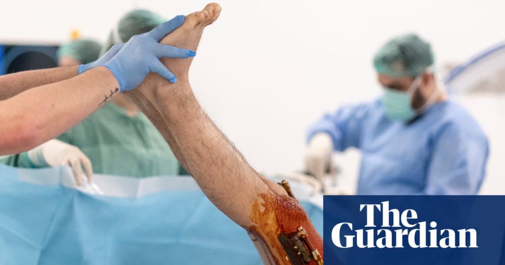It looks like medieval torture, from the metal rods inserted into sawn bones to the months of agonising recovery. But to some, travelling to Turkey to gain a few inches is a (very high) price worth pa...