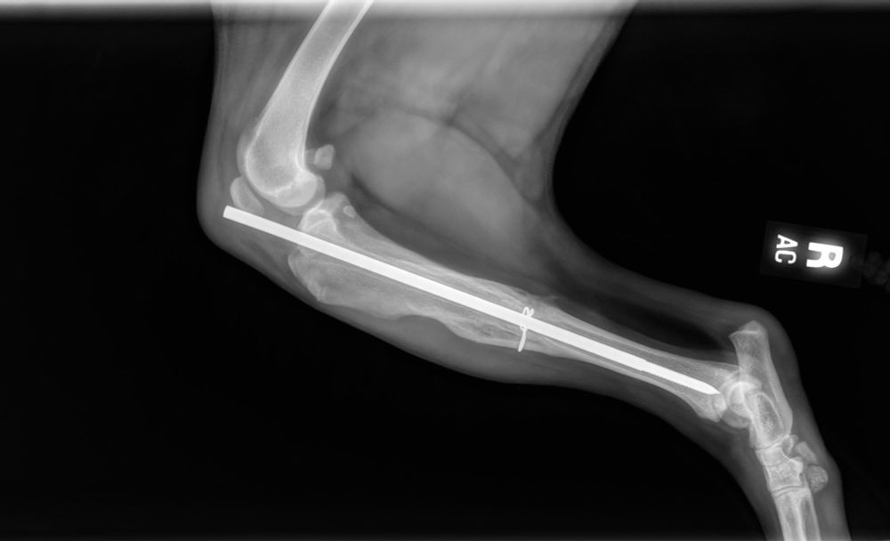 x-ray of crocker's right leg shows a very long pin inserted in his bone for stability. the pin takes up the length of his leg.