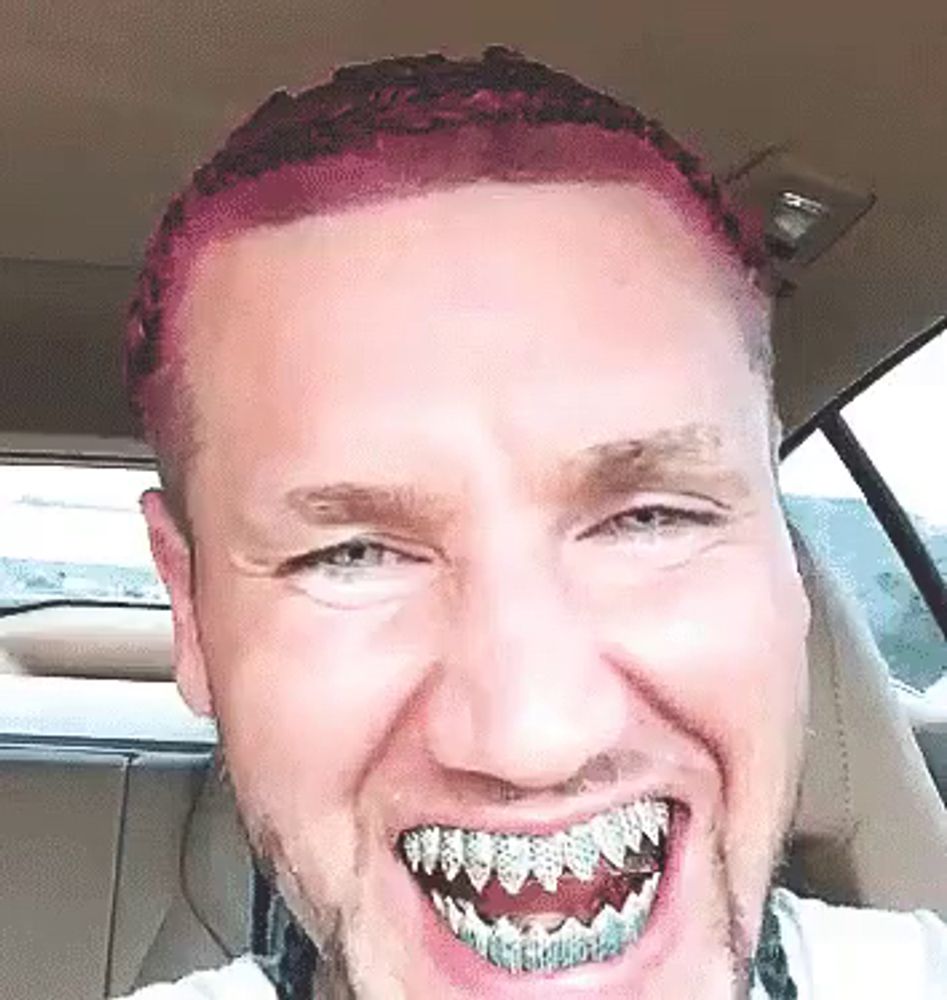 a man with pink hair and braces on his teeth is smiling in a car