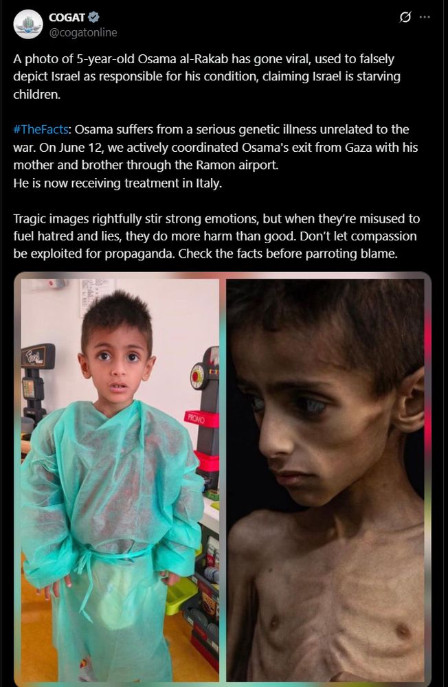 A photo of 5-year-old Osama al-Rakab has gone viral, used to falsely depict Israel as responsible for his condition, claiming Israel is starving children.

#TheFacts: Osama suffers from a serious genetic illness unrelated to the war. On June 12, we actively coordinated Osama's exit from Gaza with his mother and brother through the Ramon airport. 
He is now receiving treatment in Italy. 

Tragic images rightfully stir strong emotions, but when they’re misused to fuel hatred and lies, they do more harm than good. Don’t let compassion be exploited for propaganda. Check the facts before parroting blame.