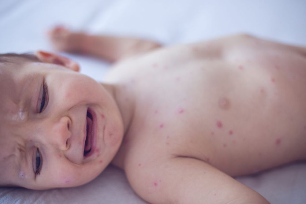 US vaccinations fall again as more parents refuse lifesaving shots for kids