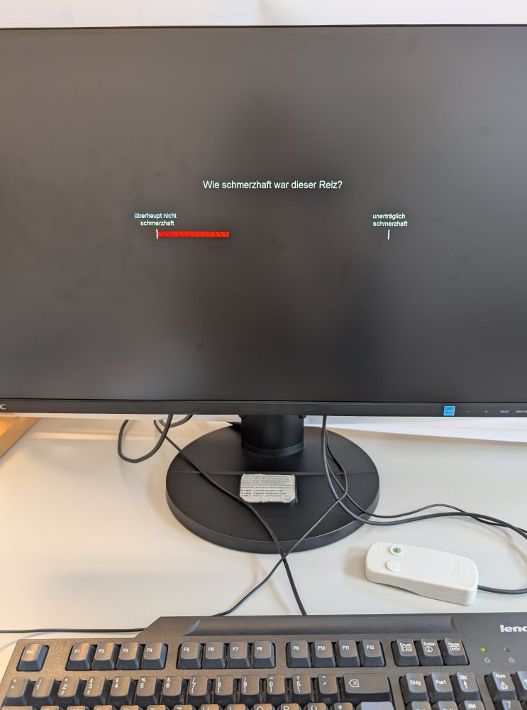 A computer screen showing a rating scale, asking how painful the stimulus was between not at all painful and extremely painful.