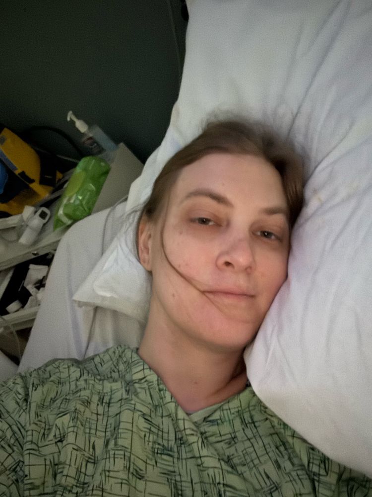 A picture of rose wearing a hospital gown laying in a hospital bed after her vaginoplasty and as usual she looks really tired