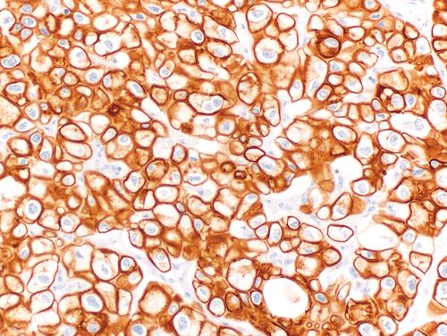 Cytokeratin 7 immunohistochemical stain