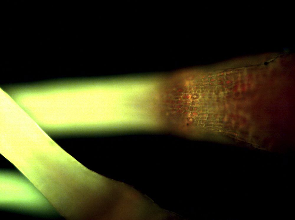 On the base of moss capsule, ring of stomata is born to assist the dehiscence and release of spores.