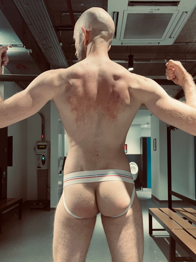 A white man flexing in a gym locker room, his back to the camera, wearing a white jockstrap. His back is covered in red marks.
