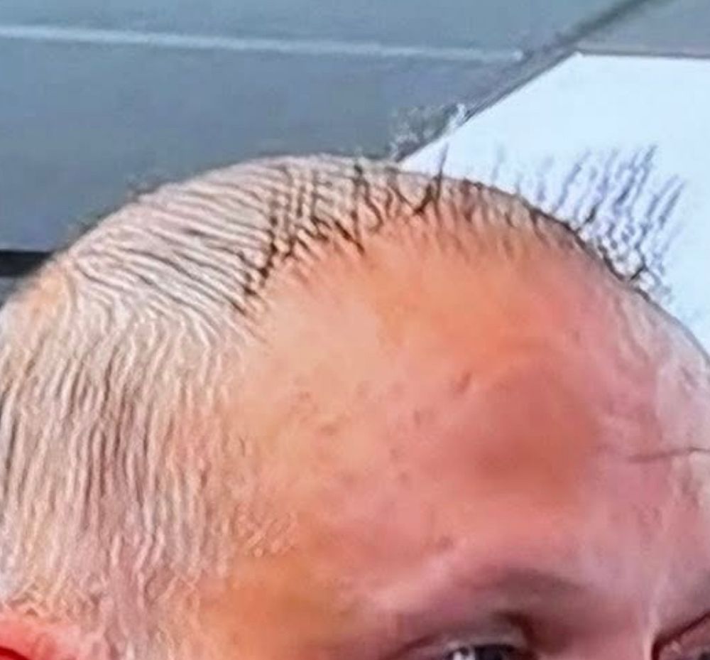 a close up of the eyelash fringe which is quite a sight (for sore eyes)