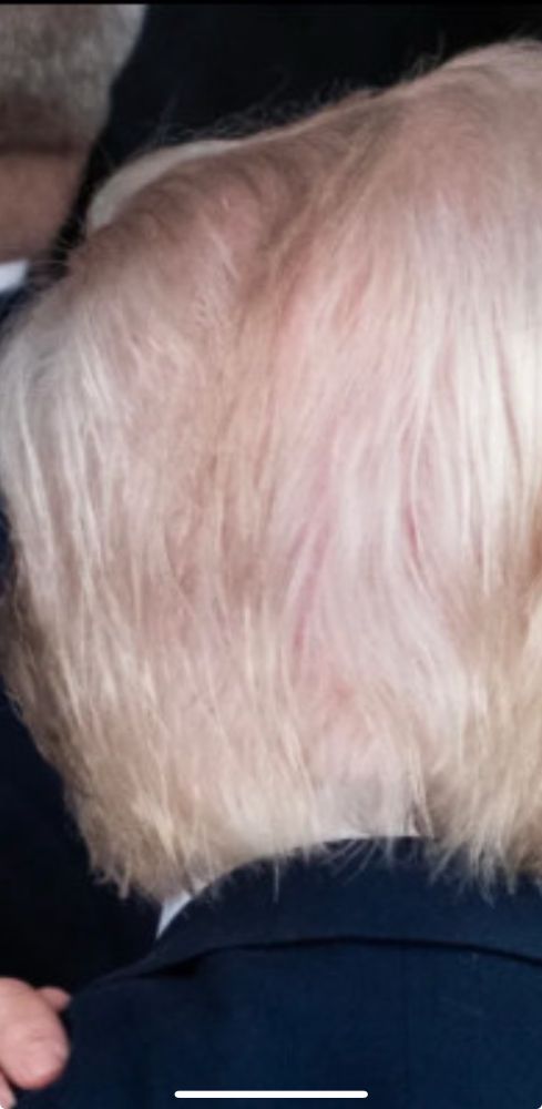 Zoom of picture. Back of Trump’s head showing a lot of pink skin shining through all the weirdly sculpted hair. 