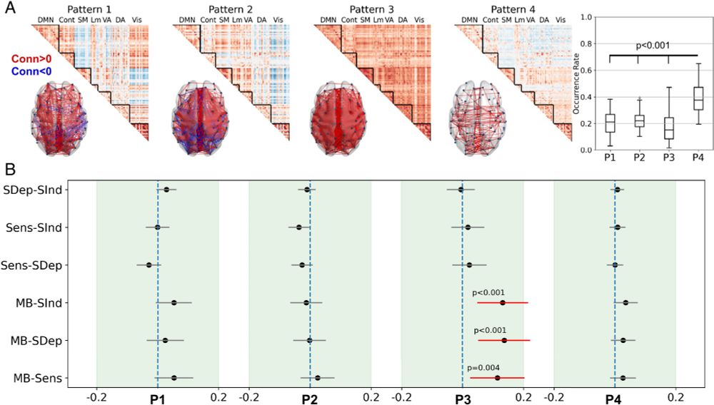 MB is associated with an overall positive interregional brain connectivity pattern. 