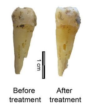 Routine techniques are destructive. They involve drilling or crushing of bone and teeth. We employed an extraction in hot water at 75-90 C to solublise collagen from archaeological bones without any visible damage.