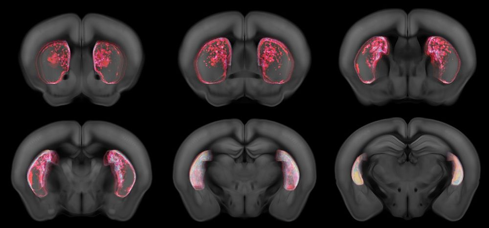 Triggered cell death in the tail of the striatum using a viral strategy. Each image is an average projection of a part of the striatum. Areas are colour coded based on their absence of neurons. Original colours are random to indicate the amount of animals that do not have cells on a particular region. The average projections then creates a mix of those original colours. Credit: Hernando Martinez Vergara