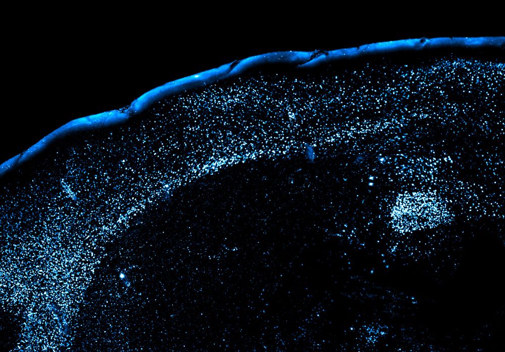 Light sheet microscopy image showing neural activation (blue) during food poisoning in the central amygdala of the mouse brain. Credit: Christopher Zimmerman