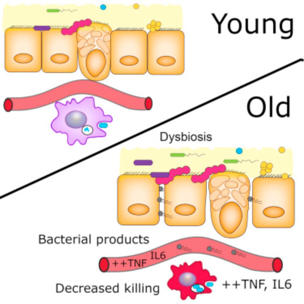 Age-Associated Microbial Dysbiosis Promotes Intestinal Permeability, Systemic Inflammation, and Macrophage Dysfunction