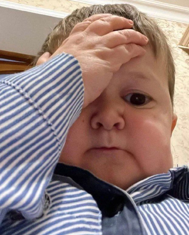 Hasbulla facepalming