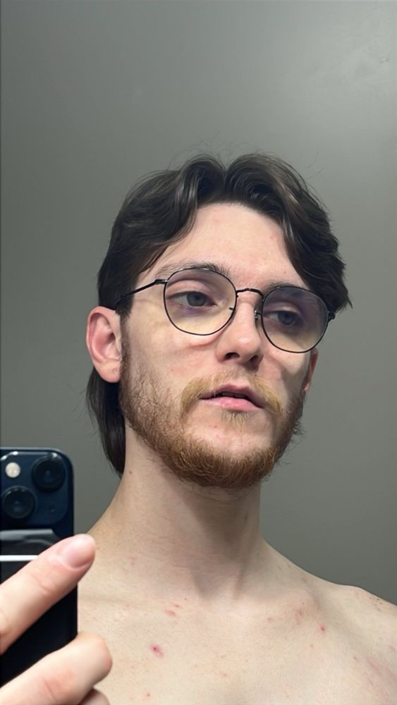 Bust photo of the user looking away from the camera no shirt on