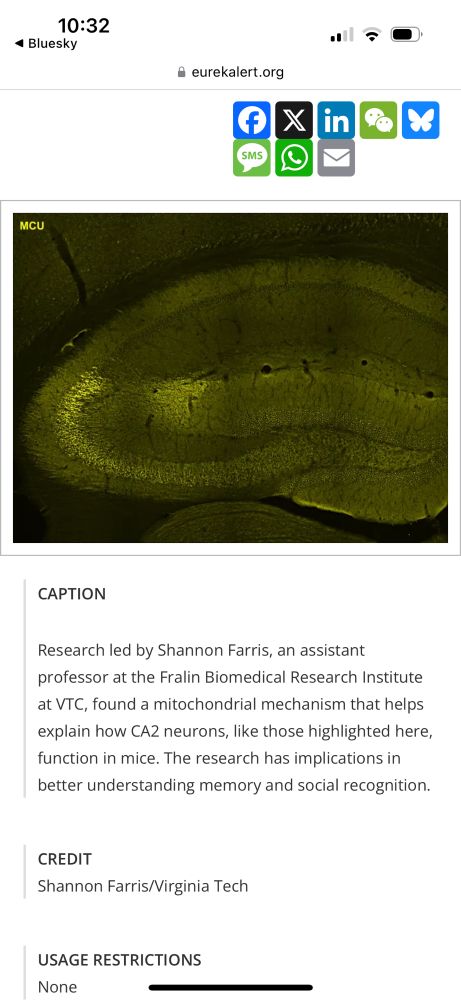 This is an image of a mouse brain section labeled for MCU that shows significant MCU staining in CA2 neuron distal dendrites compared to neighboring hippocampal subregion dendrites. 
