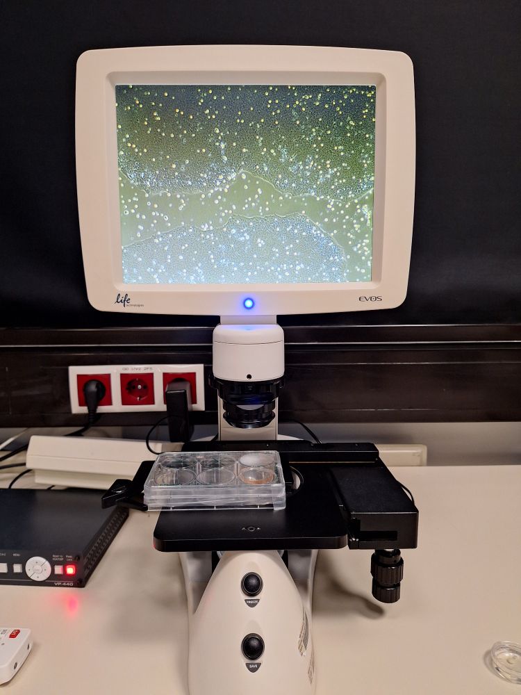 Microscope with a screen showing induced pluripotent stem cells