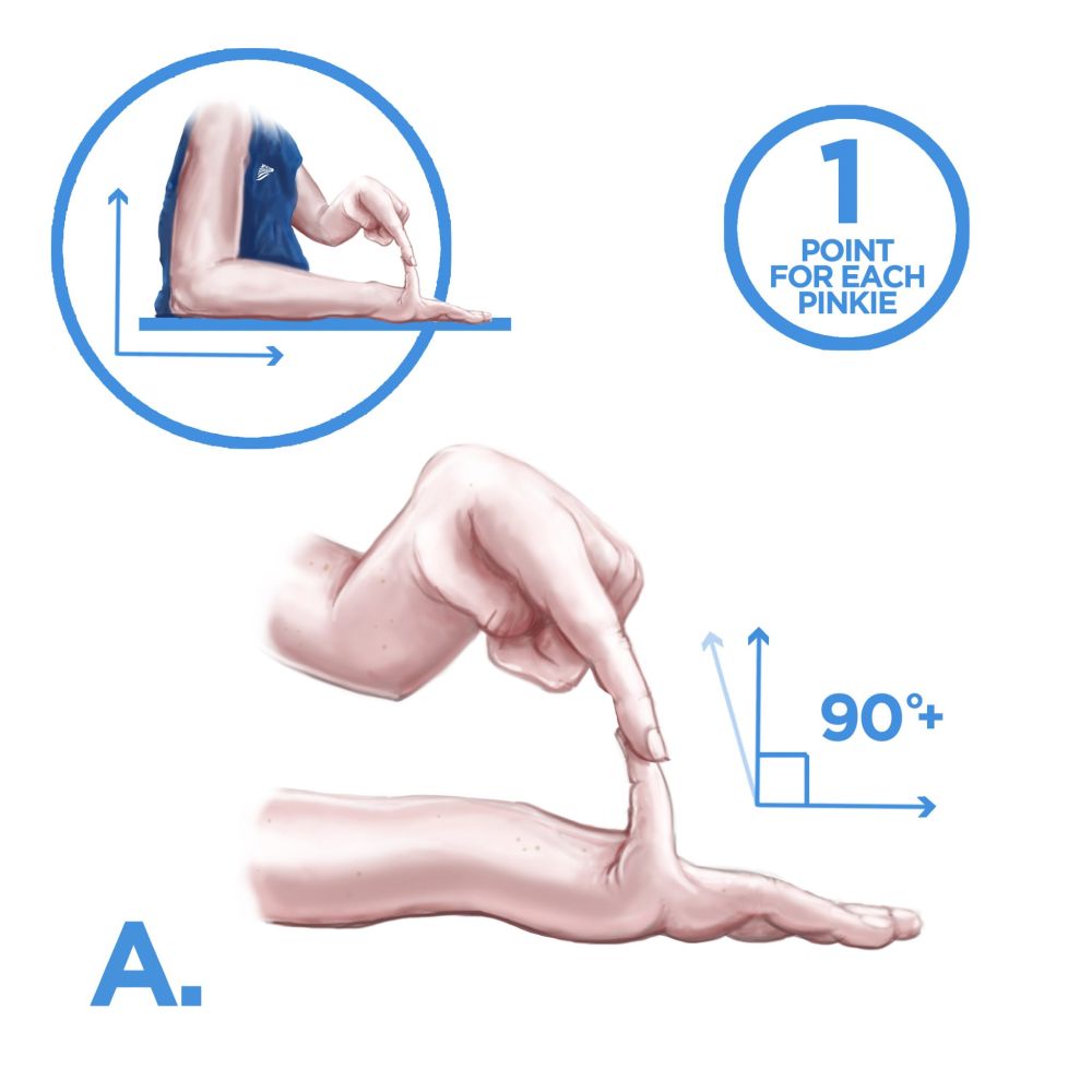 From top to bottom: illustration showing a person's arm on a flat surface with their elbow at a 90° angle, followed by, "1 point for each pinkie", followed by an illustration labeled A: a hand on a flat surface, palm down, with another hand pulling back the pinkie finger beyond a 90° angle.