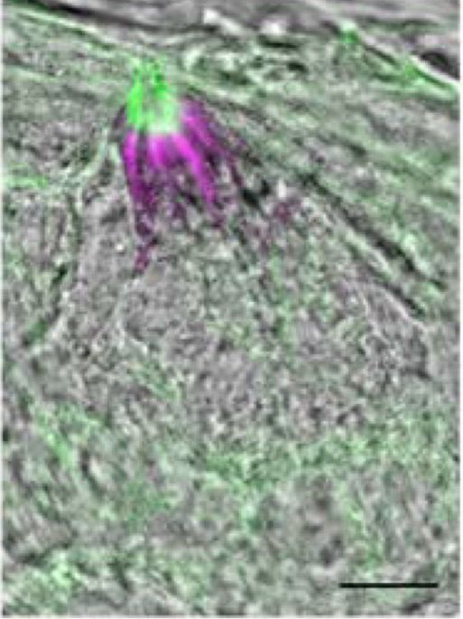 Taste bud showing OTOP in magenta and actin in green, demonstrating apical localization of OTOP1.