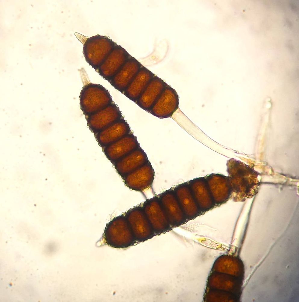 Phragmidium bulbosum teliospores