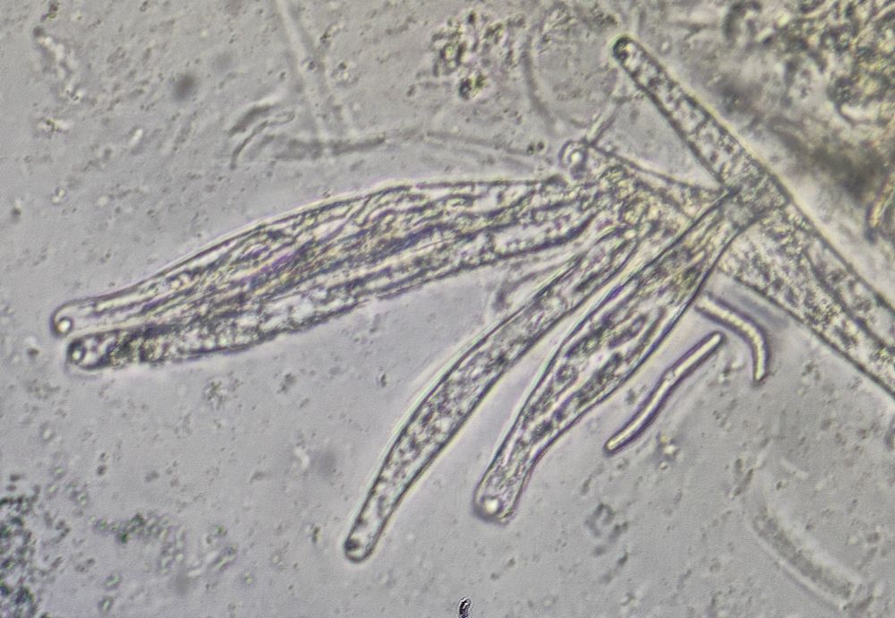 Woolly Woodwart, Lasiosphaeria ovina, asci