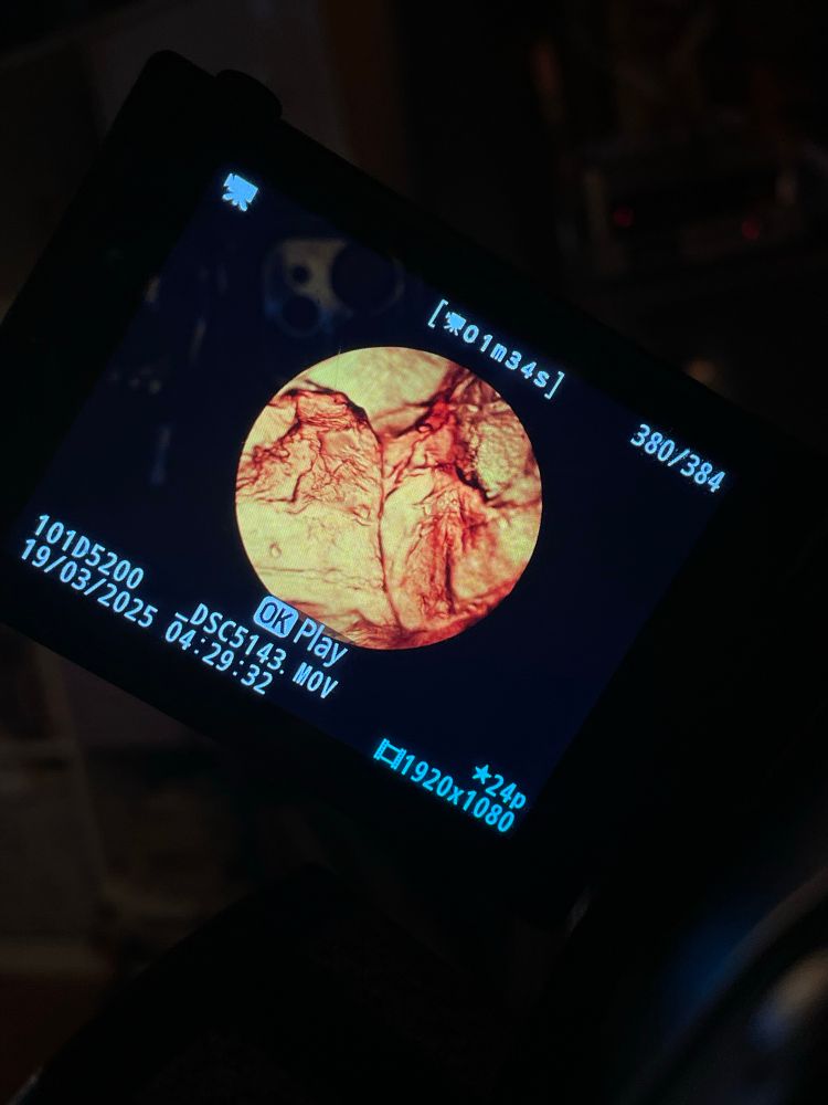 A picture of a camera view screen showing a circle of red/yellow leather textures from a microscope