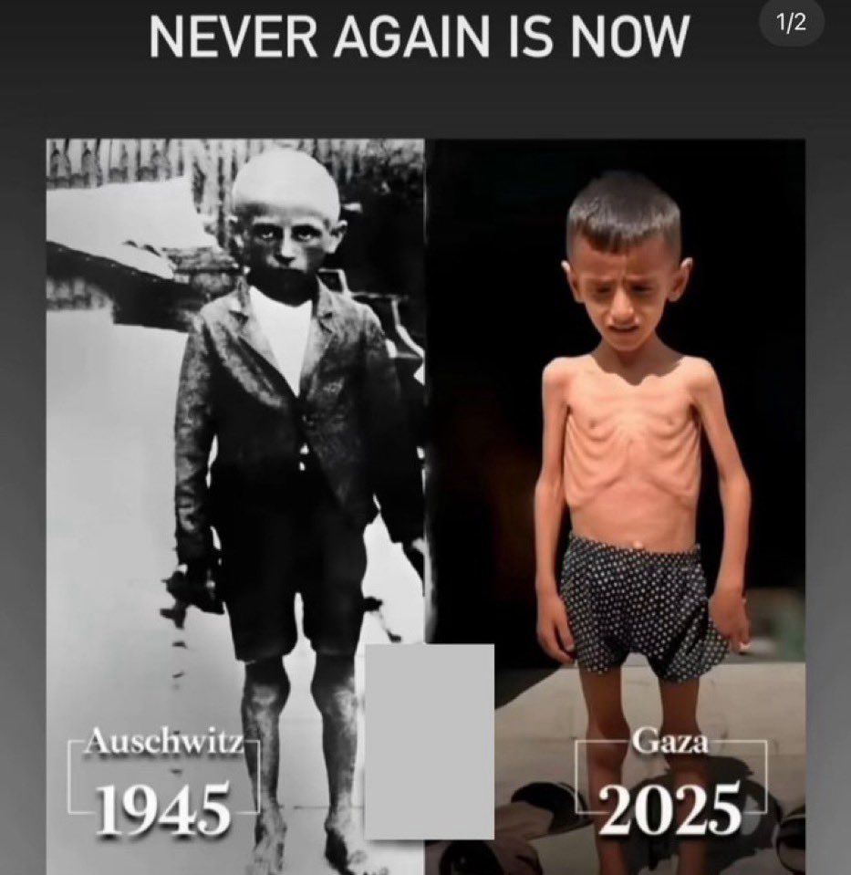 NEVER AGAIN IS NOW
Pic on left - Auschwitz 1945 Image of an emaciated, starving child, starved/war crimes by Hitler/Nazies
Pic on right - Gaza 2025  Image of an emaciated, starving child starved/war crimes by Netanyahu/IDF
