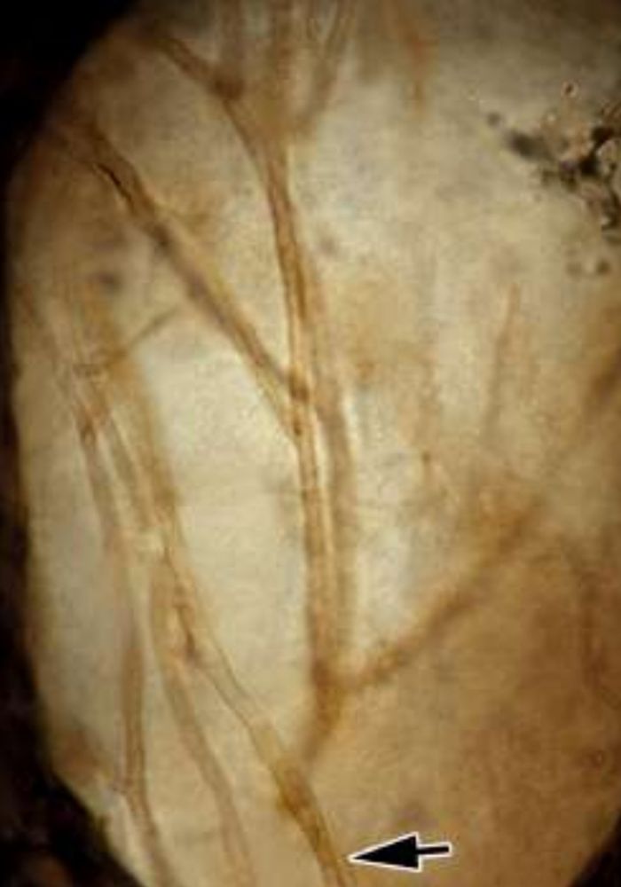 From the paper : Detail of branching fungal hyphae within the wood of Sphenophyllum. 