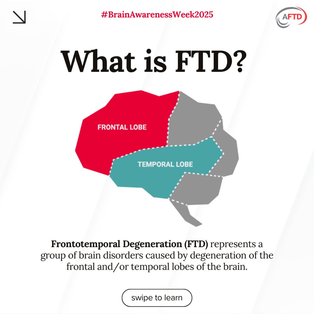 Promotional graphic for Brain Awareness Week 2025, featuring an illustration of a brain divided into the frontal and temporal lobes with a caption that reads "What is FTD?" Explanation text states that Frontotemporal Degeneration (FTD) affects the frontal and/or temporal lobes of the brain. Logo of AFTD is visible, encouraging viewers to swipe to learn more.