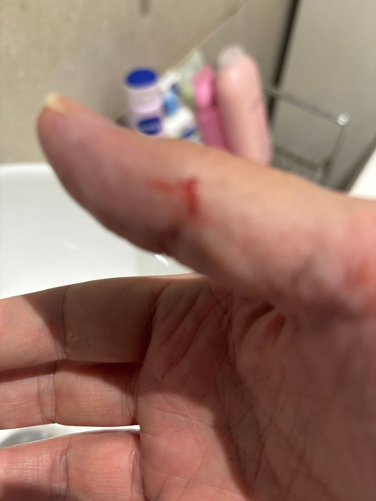 A paper cut on a thumb is bleeding