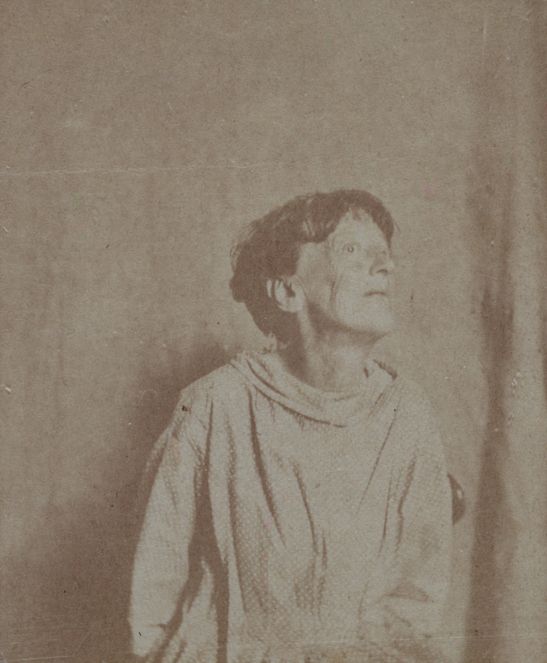 It shows a female patient in an asylum admittance photograph after have hair cut.  
(sometime in the 1800s)
