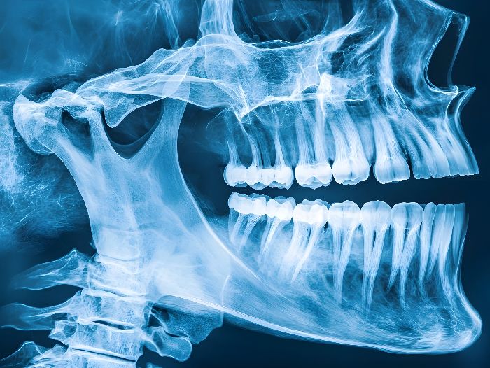 HYDROHEAL: Millorar el tractament de fractures òssies amb biomaterials avançats