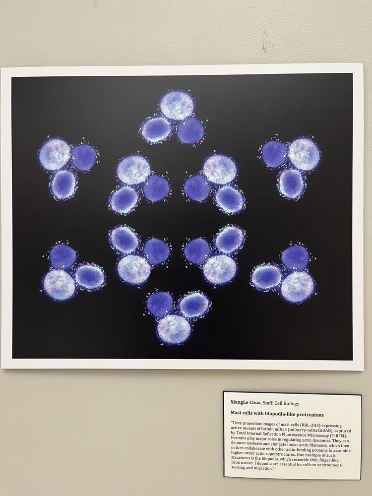 Time projection images of mast cells (RBL-2H3) expressing active mutant of formin mDia3, captured by TIRFM.