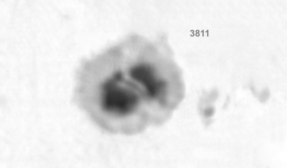 Nachreichung zum 40-Grad-Astro-Quickie: Sonnenflecken per Smartphone und Astrokamera, mit Sonnenschutzfolie am Teleskop