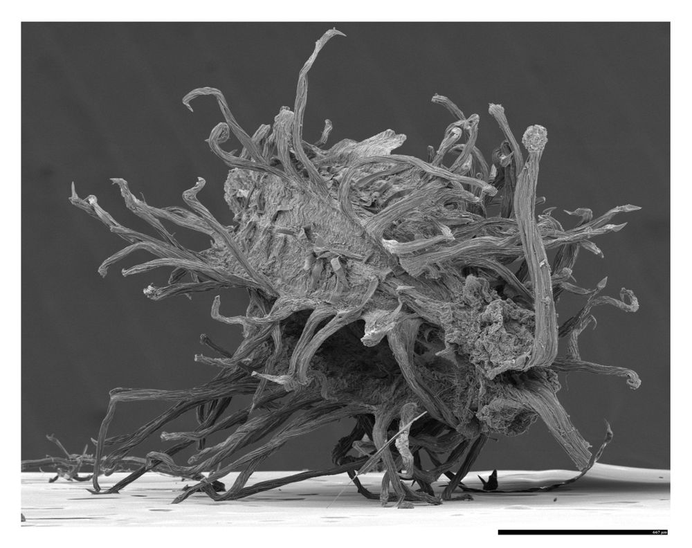 Scanning Electron Microscope image of a Daucus carota seed pod. 

Black line on the bottom of 667 μm long for scale. 