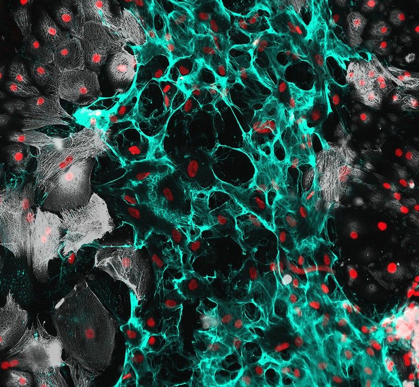 Cardiac scratch wound assay to show the role of ECM in wound healing. HiPSC Cardiomyocytes in white on the boarders with a rich ECM scar tissues (cyan) through the middle with a simple nuclear stain (red) highlighting all cells.