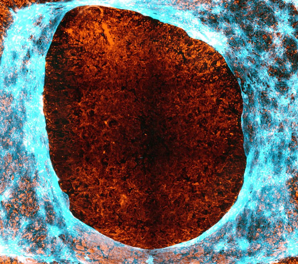 Cyan cellular extracellular matrix fibers are highlighted laying over the top of the orange hyaluronan secreted matrix after a scratch would assay.