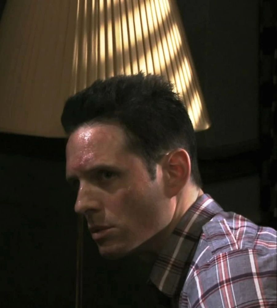 Dennis from always sunny, his face red from a chemical peel