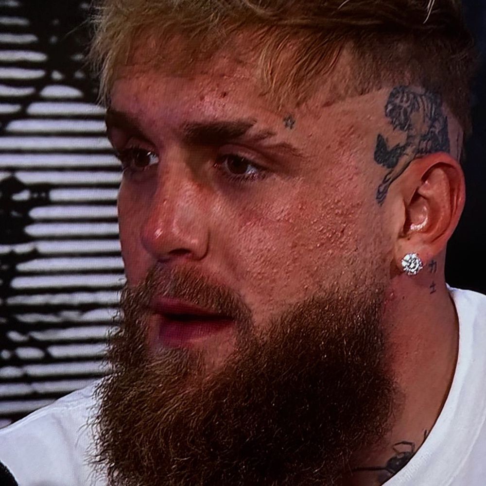 Jake Paul’s dumbass face covered in a ton of acne because he’s so geared up
