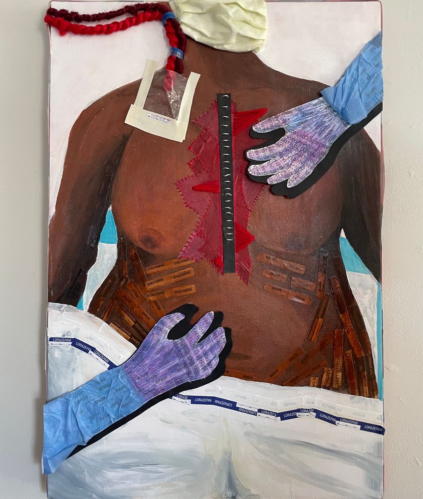 A Black woman with a sternal incision and a central line on the right side of her neck, her chest exposed, is worked on/cared for by two gloved hands.

Artist: Eli C. Rice
Materials: On canvas: acrylic paint, paper, colored pencil, yarn, embroidery floss, beading cord, glass beads, sandpaper, jewelry wire, labels for critical care medication lines, sterile wrapping, a droplet mask, synthetic braiding hair, ziploc bag, gloss medium, Gorilla Glue
Social Media: @eliricechad on Instagram

Art Description: At my job in a heart transplant ICU, I bear witness to the haze between life and death, between operating one’s own body and it yielding to the hands of strangers. This piece helped me think about the ways critical care anonymizes, yet exposes, yet uniquely marks a person and subsumes their selfhood into a History of Present Illness. I was also thinking about the Black patients in Chocolate City, more likely to experience poor health and less likely to choose any death except one with full lifesaving measures, and the care workers, fiber craftspeople, and menders of the world,  primarily women and those of marginalized genders and often women of color, and the many times we swap one life role for another.