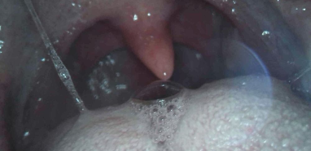 internal shot facing brin's uvula and throat, surrounded with sticky strings and bubbles of saliva