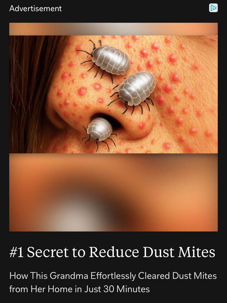 Horrifying ai image of isopods infesting a person’s nostrils