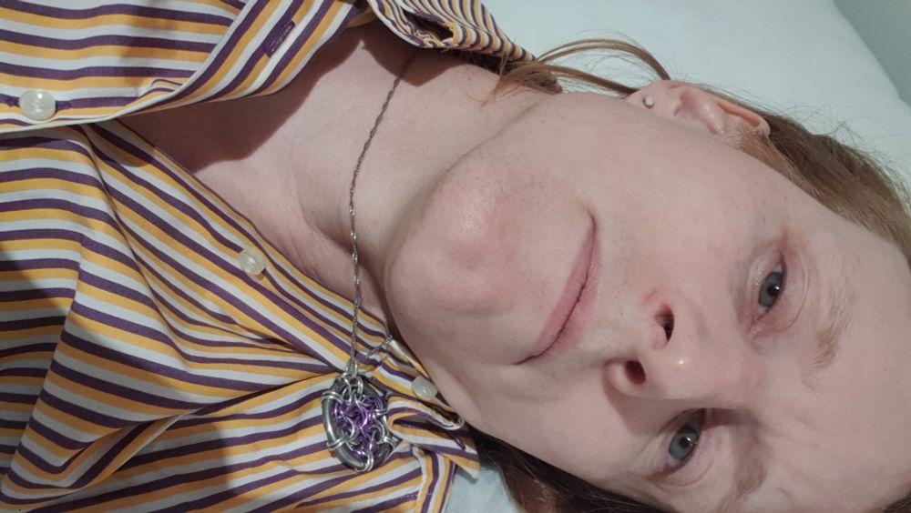 Unflattering selfie of me laying on the bed in sick bay. (Full disclosure, I took four pictures and this was the most flattering one.)