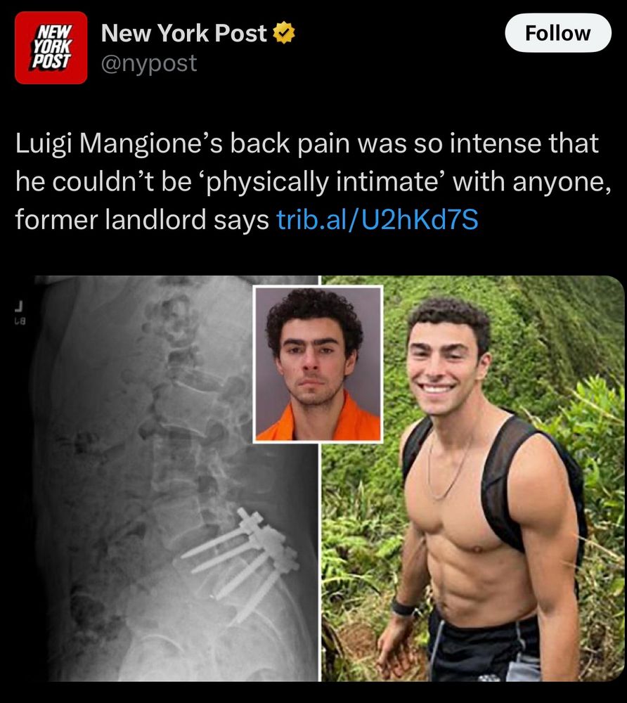 NY post article that says according to his former landlord, Luigi Mangione’s back pain was so bad he couldn’t be physically intimate with anyone