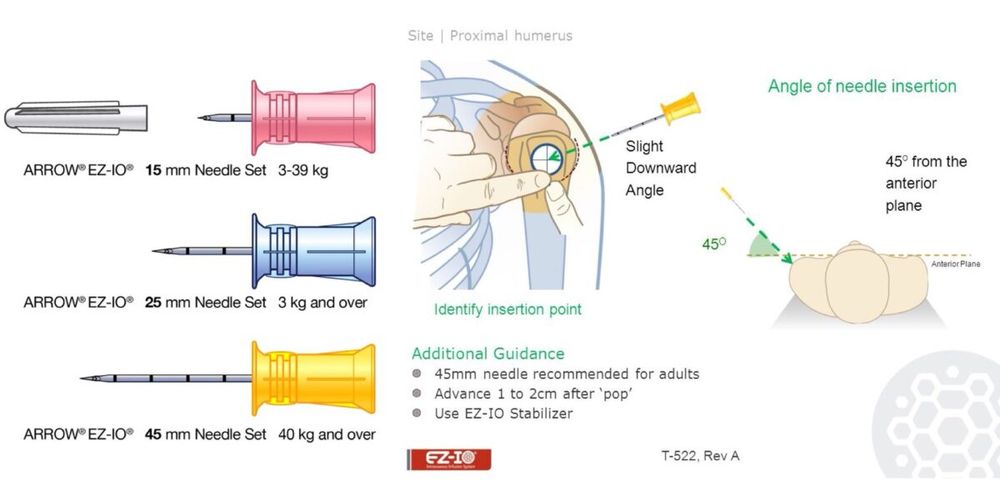 Diagrama de la regla dels 45 per a la inserció de la via IO humeral