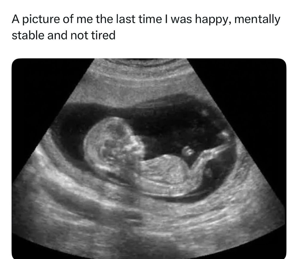 A picture of me the last time I was happy, mentally stable and not tired