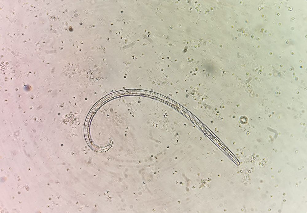 Microscopic photo of a nematode (tiny worm) from Arctic soils.